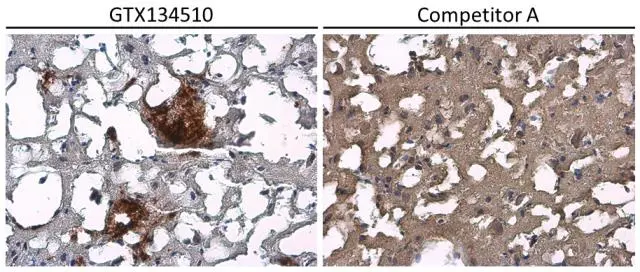 Anti-beta Amyloid (1-42) antibody – Conformation Specific Anti-beta Amyloid (1-42) antibody – Conformation Specific