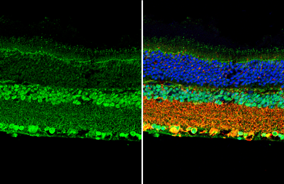 Anti-BDNF antibody (GTX134514) | GeneTex