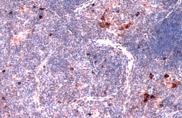 CD11b antibody detects CD11b protein at cytoplasm by immunohistochemical analysis. Sample: Paraffin-embedded mouse thymus gland. CD11b stained by CD11b antibody (GTX134542) diluted at 1:500. Antigen Retrieval: Citrate buffer, pH 6.0, 15 min
