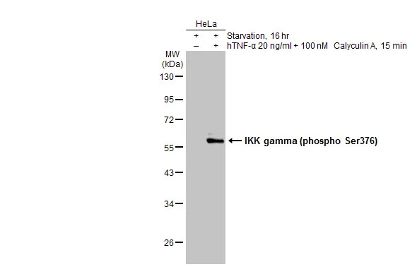 Untreated (–) and treated (+) HeLa whole cell extracts (30 μg) were separated by 10% SDS-PAGE, and the membrane was blotted with IKK gamma (phospho Ser376) antibody (GTX134550) diluted at 1:500. The HRP-conjugated anti-rabbit IgG antibody (GTX213110-01) was used to detect the primary antibody.