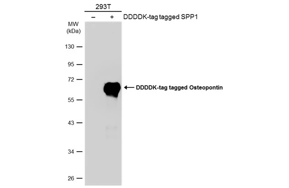 Non-transfected (–) and transfected (+) 293T whole cell extracts (30 μg) were separated by 10% SDS-PAGE, and the membrane was blotted with Osteopontin antibody (GTX134553) diluted at 1:5000. The HRP-conjugated anti-rabbit IgG antibody (GTX213110-01) was used to detect the primary antibody, and the signal was developed with Trident ECL plus-Enhanced. Non-transfected (–) and transfected (+) 293T whole cell extracts (30 μg) were separated by 10% SDS-PAGE, and the membrane was blotted with Osteopontin antibody (GTX134553) diluted at 1:5000. The HRP-conjugated anti-rabbit IgG antibody (GTX213110-01) was used to detect the primary antibody, and the signal was developed with Trident ECL plus-Enhanced.