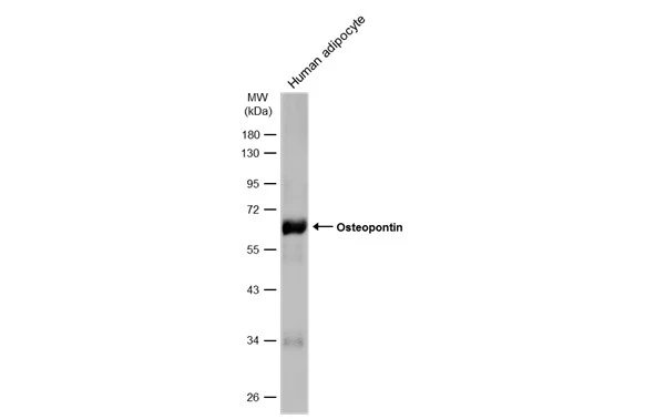 Human tissue extract (30 μg) was separated by 10% SDS-PAGE, and the membrane was blotted with Osteopontin antibody (GTX134553) diluted at 1:500. The HRP-conjugated anti-rabbit IgG antibody (GTX213110-01) was used to detect the primary antibody, and the signal was developed with Trident femto Western HRP Substrate.