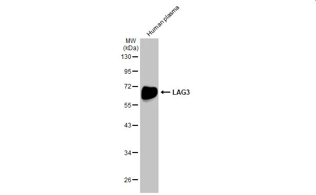 Human plasma (30 μg) was separated by 10% SDS-PAGE, and the membrane was blotted with LAG3 antibody (GTX134573) diluted at 1:1000. The HRP-conjugated anti-rabbit IgG antibody (GTX213110-01) was used to detect the primary antibody.