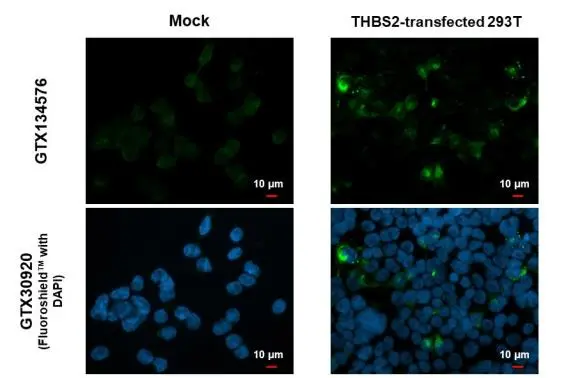 Thrombospondin 2 antibody detects Thrombospondin 2 protein by immunofluorescent analysis. Sample: Mock and transfected 293T cells were fixed in 4% paraformaldehyde at RT for 15 min. Green: Thrombospondin 2 stained by Thrombospondin 2 antibody (GTX134576) diluted at 1:500. Blue: Fluoroshield with DAPI (GTX30920).
