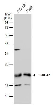 Various whole cell extracts (30 μg) were separated by 12% SDS-PAGE, and the membrane was blotted with CDC42 antibody (GTX134588) diluted at 1:1000. The HRP-conjugated anti-rabbit IgG antibody (GTX213110-01) was used to detect the primary antibody.