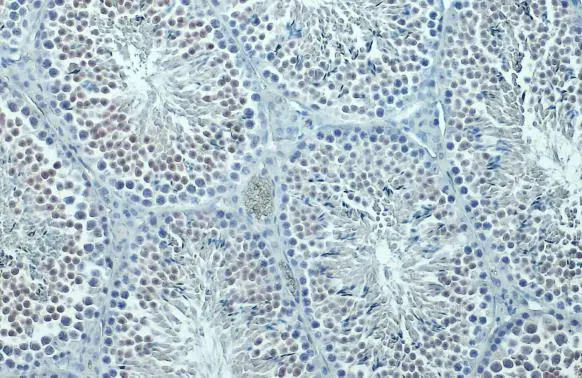 SIRT1 antibody detects SIRT1 protein at cytoplasm and nucleus by immunohistochemical analysis. Sample: Paraffin-embedded mouse testis. SIRT1 stained by SIRT1 antibody (GTX134606) diluted at 1:500. Antigen Retrieval: Citrate buffer, pH 6.0, 15 min