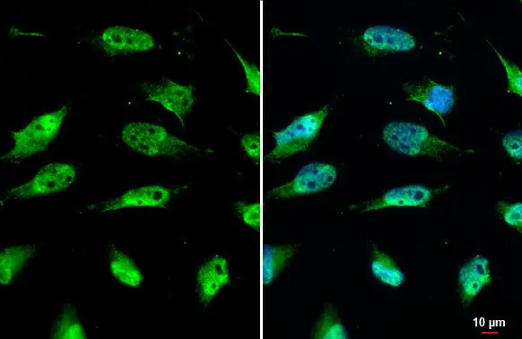 SIRT1 antibody detects SIRT1 protein at nucleus by immunofluorescent analysis. Sample: HeLa cells were fixed in 4% paraformaldehyde at RT for 15 min. Green: SIRT1 stained by SIRT1 antibody (GTX134606) diluted at 1:500.