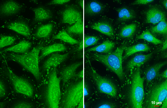 Talin-1 antibody detects Talin-1 protein at cytoplasm and focal adhesion by immunofluorescent analysis. Sample: HeLa cells were fixed in ice-cold MeOH for 5 min. Green: Talin-1 stained by Talin-1 antibody (GTX134635) diluted at 1:1000. Blue: Fluoroshield with DAPI (GTX30920). Scale bar= 10 μm. Talin-1 antibody detects Talin-1 protein at cytoplasm and focal adhesion by immunofluorescent analysis. Sample: HeLa cells were fixed in ice-cold MeOH for 5 min. Green: Talin-1 stained by Talin-1 antibody (GTX134635) diluted at 1:1000. Blue: Fluoroshield with DAPI (GTX30920). Scale bar= 10 μm.
