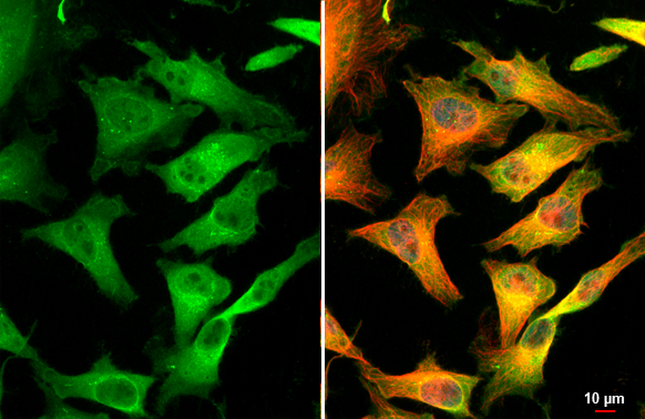 Folate Receptor alpha antibody detects Folate Receptor alpha protein at cytoplasm by immunofluorescent analysis. Sample: HeLa cells were fixed in 4% paraformaldehyde at RT for 15 min. Green: Folate Receptor alpha stained by Folate Receptor alpha antibody (GTX134660) diluted at 1:500. Red: alpha Tubulin, a cytoskeleton marker, stained by alpha Tubulin antibody [GT114] (GTX628802) diluted at 1:1000. Blue: Fluoroshield with DAPI (GTX30920). Scale bar= 10μm.