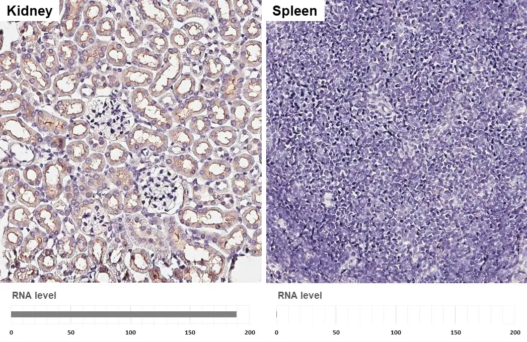 Anti-Folate Receptor alpha antibody (GTX134660) | GeneTex