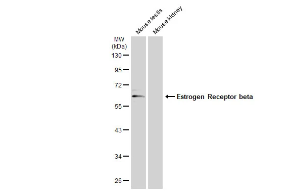 Various tissue extracts (50 μg) were separated by 10% SDS-PAGE, and the membrane was blotted with Estrogen Receptor beta antibody (GTX134663) diluted at 1:1000. The HRP-conjugated anti-rabbit IgG antibody (GTX213110-01) was used to detect the primary antibody, and the signal was developed with Trident ECL plus-Enhanced.