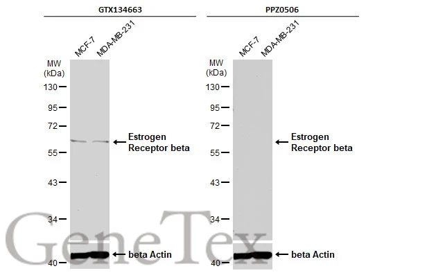 Various whole cell extracts (30 μg) were separated by 10% SDS-PAGE, and the membranes were blotted with Estrogen Receptor beta antibody (GTX134663) diluted at 1:1000 and competitor's antibody (PPZ0506) diluted at 1:100. The HRP-conjugated anti-rabbit IgG antibody (GTX213110-01) was used to detect the primary antibody. *The competitor is not affiliated with GeneTex and does not endorse this product.