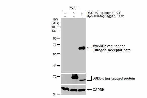Non-transfected (–) and transfected (+) 293T whole cell extracts (30 μg) were separated by 10% SDS-PAGE, and the membrane was blotted with Estrogen Receptor beta antibody (GTX134663) diluted at 1:1000. The HRP-conjugated anti-rabbit IgG antibody (GTX213110-01) was used to detect the primary antibody.
