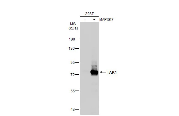 Non-transfected (–) and transfected (+) 293T whole cell extracts (30 μg) were separated by 7.5% SDS-PAGE, and the membrane was blotted with TAK1 antibody (GTX134664) diluted at 1:5000. The HRP-conjugated anti-rabbit IgG antibody (GTX213110-01) was used to detect the primary antibody. Non-transfected (–) and transfected (+) 293T whole cell extracts (30 μg) were separated by 7.5% SDS-PAGE, and the membrane was blotted with TAK1 antibody (GTX134664) diluted at 1:5000. The HRP-conjugated anti-rabbit IgG antibody (GTX213110-01) was used to detect the primary antibody.