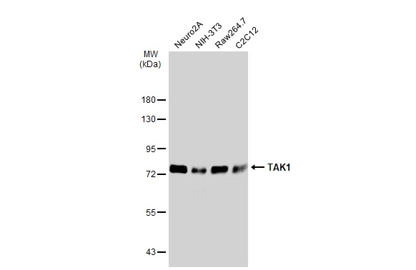 Various whole cell extracts (30 μg) were separated by 7.5% SDS-PAGE, and the membrane was blotted with TAK1 antibody (GTX134664) diluted at 1:1000. The HRP-conjugated anti-rabbit IgG antibody (GTX213110-01) was used to detect the primary antibody. Various whole cell extracts (30 μg) were separated by 7.5% SDS-PAGE, and the membrane was blotted with TAK1 antibody (GTX134664) diluted at 1:1000. The HRP-conjugated anti-rabbit IgG antibody (GTX213110-01) was used to detect the primary antibody.
