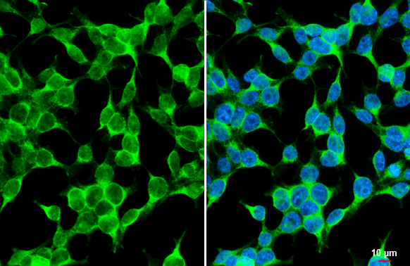 TAK1 antibody detects TAK1 protein at cell membrane and cytoplasm by immunofluorescent analysis. Sample: 293T cells were fixed in 4% paraformaldehyde at RT for 15 min. Green: TAK1 stained by TAK1 antibody (GTX134664) diluted at 1:500. Blue: Fluoroshield with DAPI (GTX30920). Scale bar= 10 μm. TAK1 antibody detects TAK1 protein at cell membrane and cytoplasm by immunofluorescent analysis. Sample: 293T cells were fixed in 4% paraformaldehyde at RT for 15 min. Green: TAK1 stained by TAK1 antibody (GTX134664) diluted at 1:500. Blue: Fluoroshield with DAPI (GTX30920). Scale bar= 10 μm.
