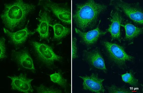 Ajuba antibody detects Ajuba protein at cytoplasm by immunofluorescent analysis. Sample: HeLa cells were fixed in ice-cold MeOH for 5 min. Green: Ajuba stained by Ajuba antibody (GTX134670) diluted at 1:500. Ajuba antibody detects Ajuba protein at cytoplasm by immunofluorescent analysis. Sample: HeLa cells were fixed in ice-cold MeOH for 5 min. Green: Ajuba stained by Ajuba antibody (GTX134670) diluted at 1:500.