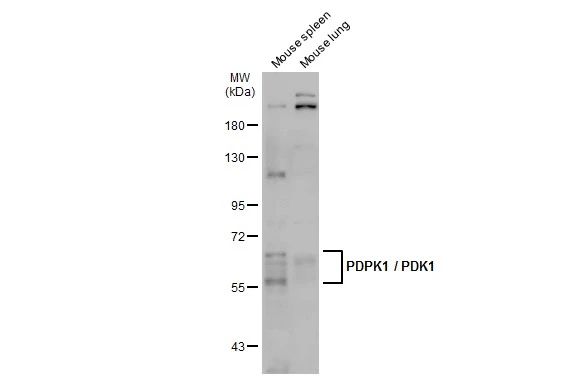 Various tissue extracts (50 μg) were separated by 7.5% SDS-PAGE, and the membrane was blotted with PDPK1 / PDK1 antibody (GTX134679) diluted at 1:1000. The HRP-conjugated anti-rabbit IgG antibody (GTX213110-01) was used to detect the primary antibody, and the signal was developed with Trident ECL plus-Enhanced.