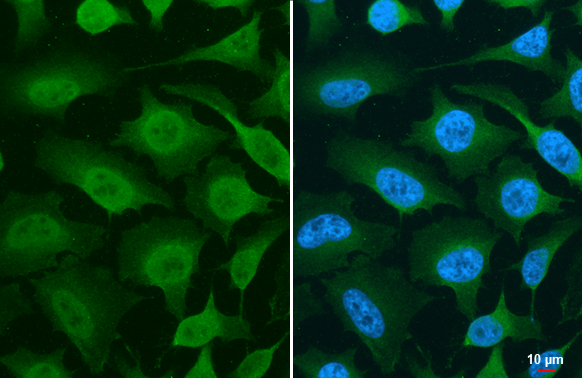 PDPK1 / PDK1 antibody detects PDPK1 / PDK1 protein at cytoplasm and nucleus by immunofluorescent analysis. Sample: HeLa cells were fixed in 4% paraformaldehyde at RT for 15 min. Green: PDPK1 / PDK1 stained by PDPK1 / PDK1 antibody (GTX134679) diluted at 1:500.