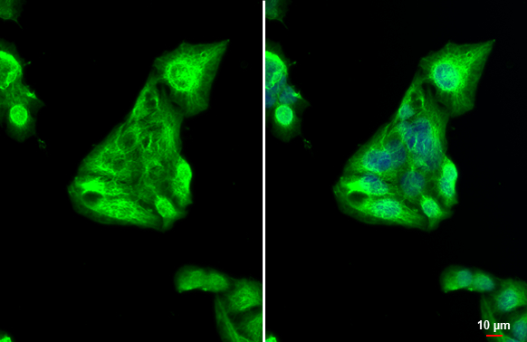 Cytokeratin 19 antibody detects Cytokeratin 19 protein at cytoskeleton by immunofluorescent analysis. Sample: HepG2 cells were fixed in 4% paraformaldehyde at RT for 15 min. Green: Cytokeratin 19 stained by Cytokeratin 19 antibody (GTX134696) diluted at 1:500. Blue: Fluoroshield with DAPI (GTX30920). Scale bar= 10μm.