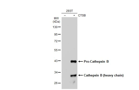 Non-transfected (–) and transfected (+) 293T whole cell extracts (30 μg) were separated by 10% SDS-PAGE, and the membrane was blotted with Cathepsin B antibody (GTX134724) diluted at 1:5000. The HRP-conjugated anti-rabbit IgG antibody (GTX213110-01) was used to detect the primary antibody.