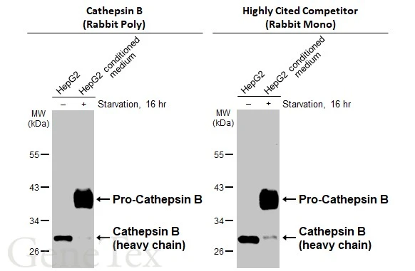 U87-MG whole cell extract and conditioned medium (30 μg) were separated by 10% SDS-PAGE, and the membranes were blotted with Cathepsin B antibody (GTX134724) diluted at 1:1000 and highly cited competitor's antibody diluted at 1:1000. The HRP-conjugated anti-rabbit IgG antibody (GTX213110-01) was used to detect the primary antibody. *The competitor is not affiliated with GeneTex and does not endorse this product. U87-MG whole cell extract and conditioned medium (30 μg) were separated by 10% SDS-PAGE, and the membranes were blotted with Cathepsin B antibody (GTX134724) diluted at 1:1000 and highly cited competitor's antibody diluted at 1:1000. The HRP-conjugated anti-rabbit IgG antibody (GTX213110-01) was used to detect the primary antibody. *The competitor is not affiliated with GeneTex and does not endorse this product.