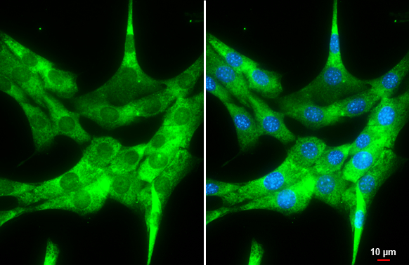 FMRP antibody