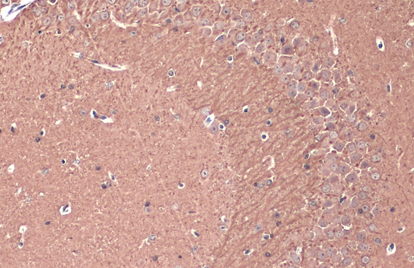 Teneurin 1 antibody detects Teneurin 1 protein at cell membrane and cytoplasm by immunohistochemical analysis. Sample: Paraffin-embedded mouse hippocampus. Teneurin 1 stained by Teneurin 1 antibody (GTX134739) diluted at 1:200. Antigen Retrieval: Citrate buffer, pH 6.0, 15 min