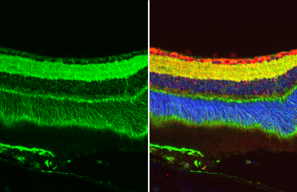 GPM6A antibody