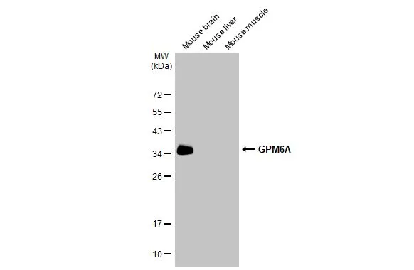 GPM6A antibody