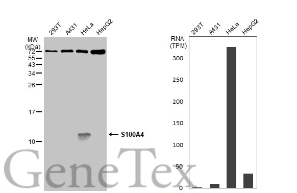 Various whole cell extracts (30 μg) were separated by 15% SDS-PAGE, and the membrane was blotted with S100A4 antibody (GTX134743) diluted at 1:1000. The HRP-conjugated anti-rabbit IgG antibody (GTX213110-01) was used to detect the primary antibody. Corresponding RNA expression data for the same cell lines are based on Human Protein Atlas program.