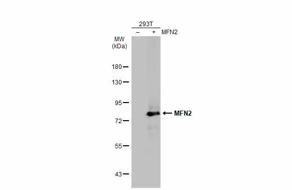 Non-transfected (–) and transfected (+) 293T whole cell extracts (30 μg) were separated by 7.5% SDS-PAGE, and the membrane was blotted with MFN2 antibody (GTX134774) diluted at 1:1000. The HRP-conjugated anti-rabbit IgG antibody (GTX213110-01) was used to detect the primary antibody.