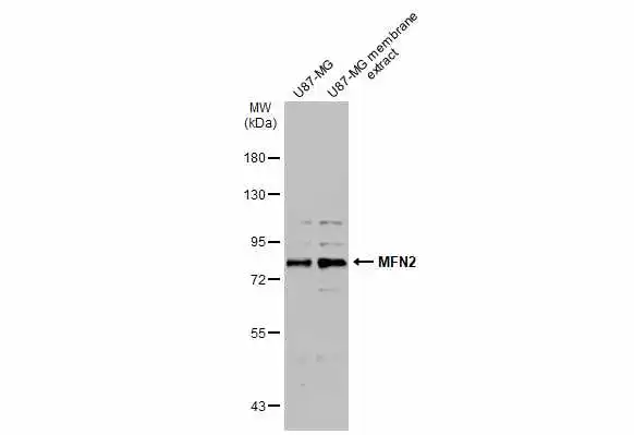 U87-MG whole cell and membrane extracts (30 μg) were separated by 7.5% SDS-PAGE, and the membrane was blotted with MFN2 antibody (GTX134774) diluted at 1:1000. The HRP-conjugated anti-rabbit IgG antibody (GTX213110-01) was used to detect the primary antibody.