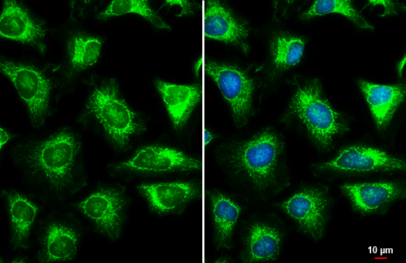 TOMM22 antibody detects TOMM22 protein at mitochondria by immunofluorescent analysis. Sample: HeLa cells were fixed in ice-cold MeOH for 5 min. Green: TOMM22 stained by TOMM22 antibody (GTX134799) diluted at 1:500. Blue: Hoechst 33342 staining. Scale bar= 10 μm.