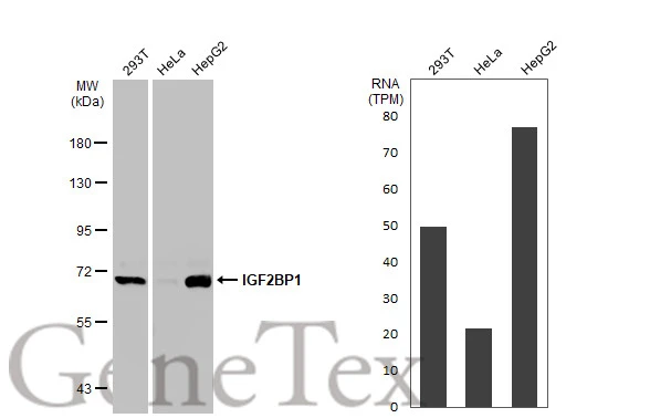 Various whole cell extracts (30 μg) were separated by 7.5% SDS-PAGE, and the membrane was blotted with IGF2BP1 antibody (GTX134816) diluted at 1:1000. The HRP-conjugated anti-rabbit IgG antibody (GTX213110-01) was used to detect the primary antibody.Corresponding RNA expression data for the same cell lines are based on Human Protein Atlas program.