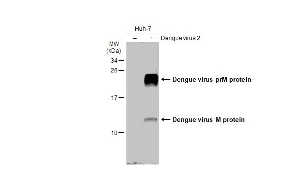 Non-infected (–) and infected (+) Huh-7 whole cell extracts (15 μg) were separated by 15% SDS-PAGE, and the membrane was blotted with Dengue virus prM protein antibody (GTX134828) diluted at 1:1000. The HRP-conjugated anti-rabbit IgG antibody (GTX213110-01) was used to detect the primary antibody.