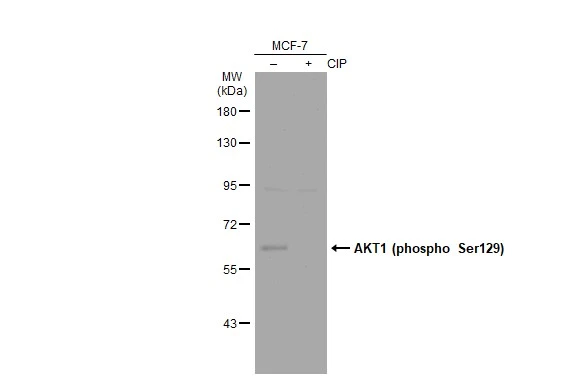 Untreated (–) and treated (+) Various whole cell extracts (30 μg) were separated by 7.5% SDS-PAGE, and the membrane was blotted with AKT1 (phospho Ser129) antibody (GTX134836) diluted at 1:500. The HRP-conjugated anti-rabbit IgG antibody (GTX213110-01) was used to detect the primary antibody.