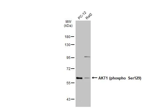 Various whole cell extracts (30 μg) were separated by 7.5% SDS-PAGE, and the membrane was blotted with AKT1 (phospho Ser129) antibody (GTX134836) diluted at 1:1000. The HRP-conjugated anti-rabbit IgG antibody (GTX213110-01) was used to detect the primary antibody, and the signal was developed with Trident ECL plus-Enhanced.