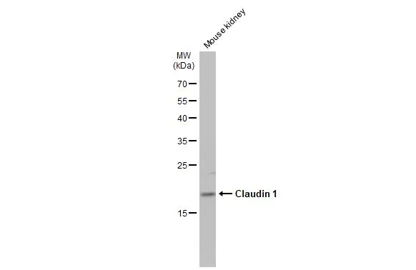 Mouse tissue extract (50 μg) was separated by 12% SDS-PAGE, and the membrane was blotted with Claudin 1 antibody (GTX134842) diluted at 1:1000. The HRP-conjugated anti-rabbit IgG antibody (GTX213110-01) was used to detect the primary antibody.