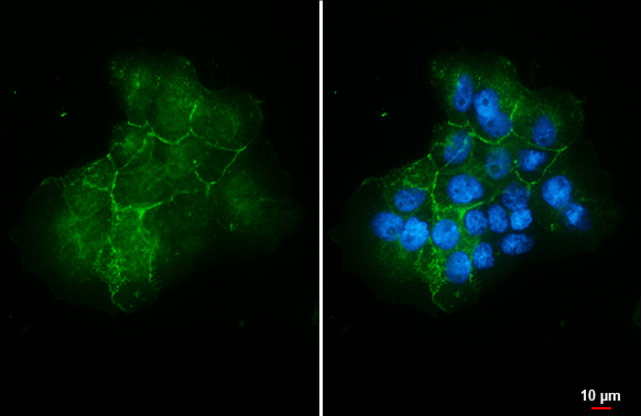 Claudin 1 antibody detects Claudin 1 protein at cell membrane by immunofluorescent analysis. Sample: A431 cells were fixed in 4% paraformaldehyde at RT for 15 min. Green: Claudin 1 stained by Claudin 1 antibody (GTX134842) diluted at 1:1000. Blue: Fluoroshield with DAPI (GTX30920). Scale bar= 10 μm.