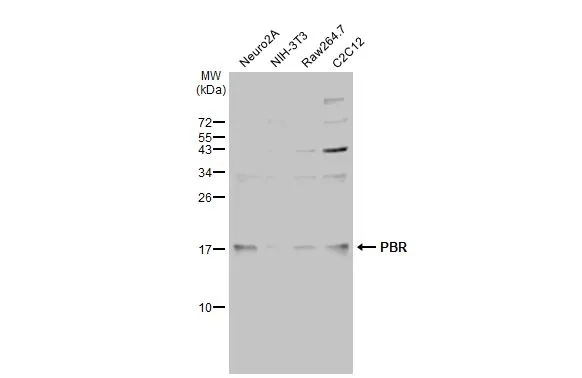 Various whole cell extracts (30 μg) were separated by 15% SDS-PAGE, and the membrane was blotted with PBR antibody (GTX134851) diluted at 1:1000. The HRP-conjugated anti-rabbit IgG antibody (GTX213110-01) was used to detect the primary antibody.