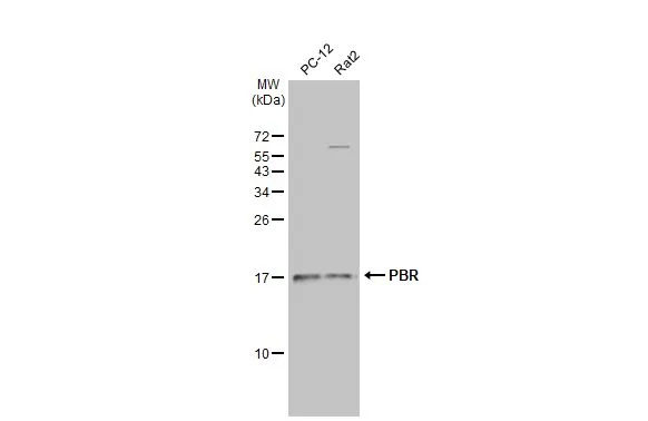 Various whole cell extracts (30 μg) were separated by 15% SDS-PAGE, and the membrane was blotted with PBR antibody (GTX134851) diluted at 1:1000. The HRP-conjugated anti-rabbit IgG antibody (GTX213110-01) was used to detect the primary antibody.