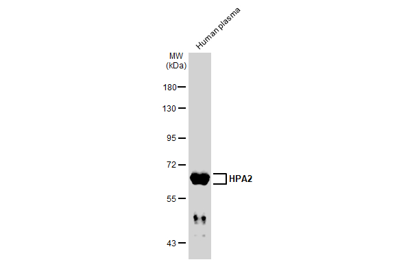 Human plasma (30 μg) was separated by 7.5% SDS-PAGE, and the membrane was blotted with HPA2 antibody (GTX134852) diluted at 1:5000. The HRP-conjugated anti-rabbit IgG antibody (GTX213110-01) was used to detect the primary antibody.