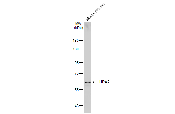 Mouse plasma (50 μg) was separated by 7.5% SDS-PAGE, and the membrane was blotted with HPA2 antibody (GTX134852) diluted at 1:5000. The HRP-conjugated anti-rabbit IgG antibody (GTX213110-01) was used to detect the primary antibody.