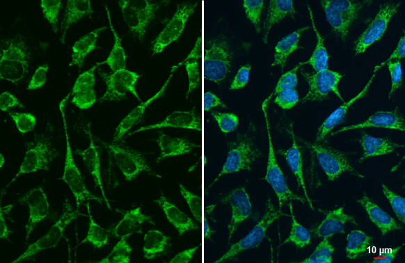 DLST antibody detects DLST protein at mitochondria by immunofluorescent analysis. Sample: HeLa cells were fixed in ice-cold MeOH for 5 min. Green: DLST stained by DLST antibody (GTX134855) diluted at 1:500.