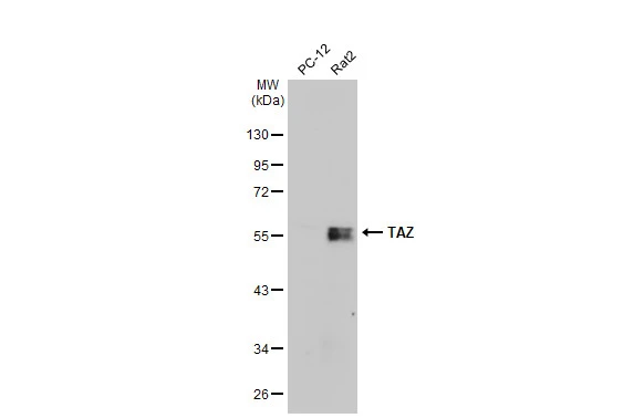Various whole cell extracts (30 μg) were separated by 10% SDS-PAGE, and the membrane was blotted with TAZ antibody (GTX134857) diluted at 1:3000. The HRP-conjugated anti-rabbit IgG antibody (GTX213110-01) was used to detect the primary antibody.