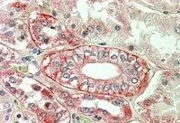 IHC-P analysis of human kidney using GTX13493 Flotillin 1 antibody, C-term. Antigen retrieval : citrate buffer pH 6 Dilution : 3.8microg/ml IHC-P analysis of human kidney using GTX13493 Flotillin 1 antibody, C-term. Antigen retrieval : citrate buffer pH 6 Dilution : 3.8microg/ml