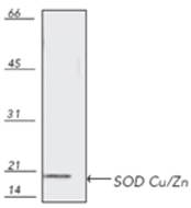 Western blot analysis: rat brain tissue extract,probed with Cu/Zn SOD pAb.