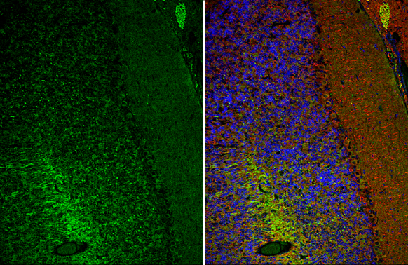 CaMKII antibody
