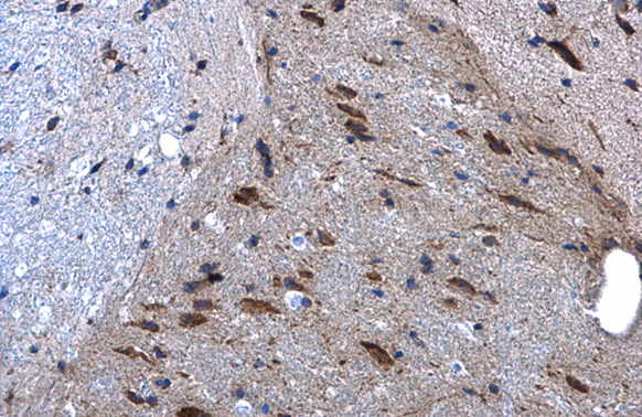 CaMKII antibody